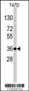 NANOS1 antibody, TA324534, Origene, Western Blot image 