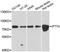 Intraflagellar Transport 74 antibody, A12672, ABclonal Technology, Western Blot image 