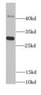 Dimethylarginine Dimethylaminohydrolase 2 antibody, FNab02283, FineTest, Western Blot image 