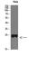Parathyroid Hormone Like Hormone antibody, STJ98621, St John