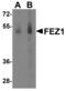 Fasciculation And Elongation Protein Zeta 1 antibody, NBP1-76395, Novus Biologicals, Western Blot image 