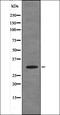 Pancreas/duodenum homeobox protein 1 antibody, orb335969, Biorbyt, Western Blot image 