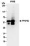6-Phosphofructo-2-Kinase/Fructose-2,6-Biphosphatase 2 antibody, NBP2-32194, Novus Biologicals, Immunoprecipitation image 