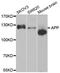 Amyloid Beta Precursor Protein antibody, A3161, ABclonal Technology, Western Blot image 