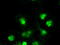 TYRO3 Protein Tyrosine Kinase antibody, LS-C784245, Lifespan Biosciences, Immunofluorescence image 