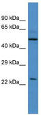 Ubiquilin-4 antibody, TA344808, Origene, Western Blot image 