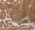Peroxiredoxin 3 antibody, A3076, ABclonal Technology, Immunohistochemistry paraffin image 