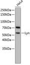 LYN Proto-Oncogene, Src Family Tyrosine Kinase antibody, 14-197, ProSci, Western Blot image 