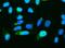 Ribonuclease/Angiogenin Inhibitor 1 antibody, M04147, Boster Biological Technology, Immunofluorescence image 
