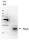 Probable 26S proteasome regulatory subunit p28 antibody, GTX64141, GeneTex, Western Blot image 