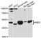 Methyl-CpG-binding domain protein 2 antibody, A01746, Boster Biological Technology, Western Blot image 