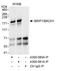Fanconi anemia group J protein antibody, A300-561A, Bethyl Labs, Immunoprecipitation image 