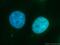 RECQ4 antibody, 17008-1-AP, Proteintech Group, Immunofluorescence image 