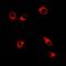 Collagen Type X Alpha 1 Chain antibody, orb10444, Biorbyt, Immunofluorescence image 