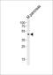 Pancreatic And Duodenal Homeobox 1 antibody, PA5-72207, Invitrogen Antibodies, Western Blot image 