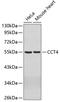 Chaperonin Containing TCP1 Subunit 4 antibody, 19-050, ProSci, Western Blot image 