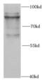 Promyelocytic Leukemia antibody, FNab06572, FineTest, Western Blot image 