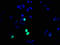 Histone Cluster 1 H1 Family Member E antibody, LS-C675309, Lifespan Biosciences, Immunofluorescence image 