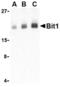 Peptidyl-tRNA hydrolase 2, mitochondrial antibody, TA306252, Origene, Western Blot image 