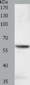SOCS7 antibody, TA321633, Origene, Western Blot image 