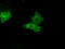 Proteasome 26S Subunit, ATPase 3 antibody, TA500922, Origene, Immunofluorescence image 
