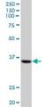 Zinc Finger C4H2-Type Containing antibody, H00055906-B01P, Novus Biologicals, Western Blot image 