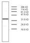 Protein S100-A7 antibody, AM32963PU-N, Origene, Western Blot image 