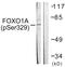 Forkhead Box O1 antibody, OAAF07382, Aviva Systems Biology, Western Blot image 