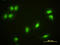 Cryptochrome Circadian Regulator 1 antibody, LS-B5393, Lifespan Biosciences, Immunofluorescence image 