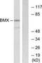BMX Non-Receptor Tyrosine Kinase antibody, TA311907, Origene, Western Blot image 