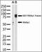 Protein Inhibitor Of Activated STAT 4 antibody, PA5-11346, Invitrogen Antibodies, Western Blot image 