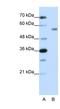 Zinc Finger Protein 497 antibody, NBP1-80438, Novus Biologicals, Western Blot image 