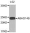 Abhydrolase Domain Containing 14B antibody, LS-C332632, Lifespan Biosciences, Western Blot image 