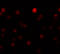 Zinc Finger E-Box Binding Homeobox 1 antibody, 5825, ProSci Inc, Immunofluorescence image 