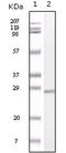 S100 Calcium Binding Protein A1 antibody, STJ98373, St John
