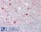 Phospholipase A2 Group III antibody, LS-B12471, Lifespan Biosciences, Immunohistochemistry paraffin image 