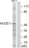 Ribosomal RNA-processing protein 8 antibody, abx014346, Abbexa, Western Blot image 