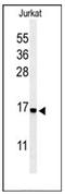 Ribosomal Protein S25 antibody, AP53739PU-N, Origene, Western Blot image 
