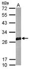 Glutathione S-Transferase Mu 1 antibody, TA308892, Origene, Western Blot image 