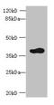 ADP Ribosylation Factor Interacting Protein 2 antibody, orb353919, Biorbyt, Western Blot image 