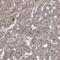 Protein Kinase D1 antibody, NBP1-87789, Novus Biologicals, Immunohistochemistry paraffin image 