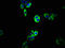ATP Binding Cassette Subfamily C Member 5 antibody, LS-C671452, Lifespan Biosciences, Immunofluorescence image 