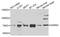 Probable alpha-ketoglutarate-dependent dioxygenase ABH4 antibody, A09200, Boster Biological Technology, Western Blot image 