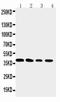 DNA repair protein XRCC3 antibody, LS-C312851, Lifespan Biosciences, Western Blot image 