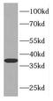 Family With Sequence Similarity 49 Member B antibody, FNab02987, FineTest, Western Blot image 