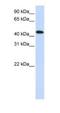 MAP kinase-interacting serine/threonine-protein kinase 2 antibody, NBP1-58899, Novus Biologicals, Western Blot image 