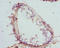 Catenin Beta Like 1 antibody, LS-C675605, Lifespan Biosciences, Immunohistochemistry paraffin image 