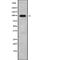 Chloride Voltage-Gated Channel 2 antibody, abx149377, Abbexa, Western Blot image 
