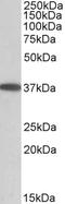 Monoacylglycerol O-Acyltransferase 2 antibody, orb20649, Biorbyt, Western Blot image 