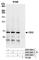 Chromobox 2 antibody, A302-524A, Bethyl Labs, Western Blot image 